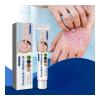 Southmoon Psoriasis Removal Ointment Eczema Best Anti Dermatitis, 20g-35256-01