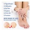 Southmoon Psoriasis Removal Ointment Eczema Best Anti Dermatitis, 20g-35261-01
