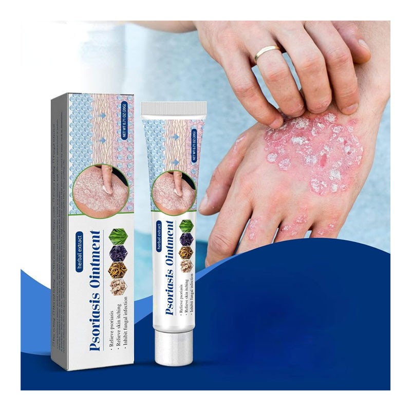 Southmoon Psoriasis Removal Ointment Eczema Best Anti Dermatitis, 20g-35256