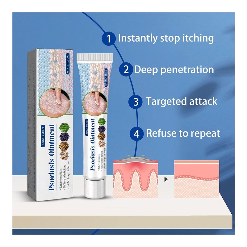 Southmoon Psoriasis Removal Ointment Eczema Best Anti Dermatitis, 20g-35259